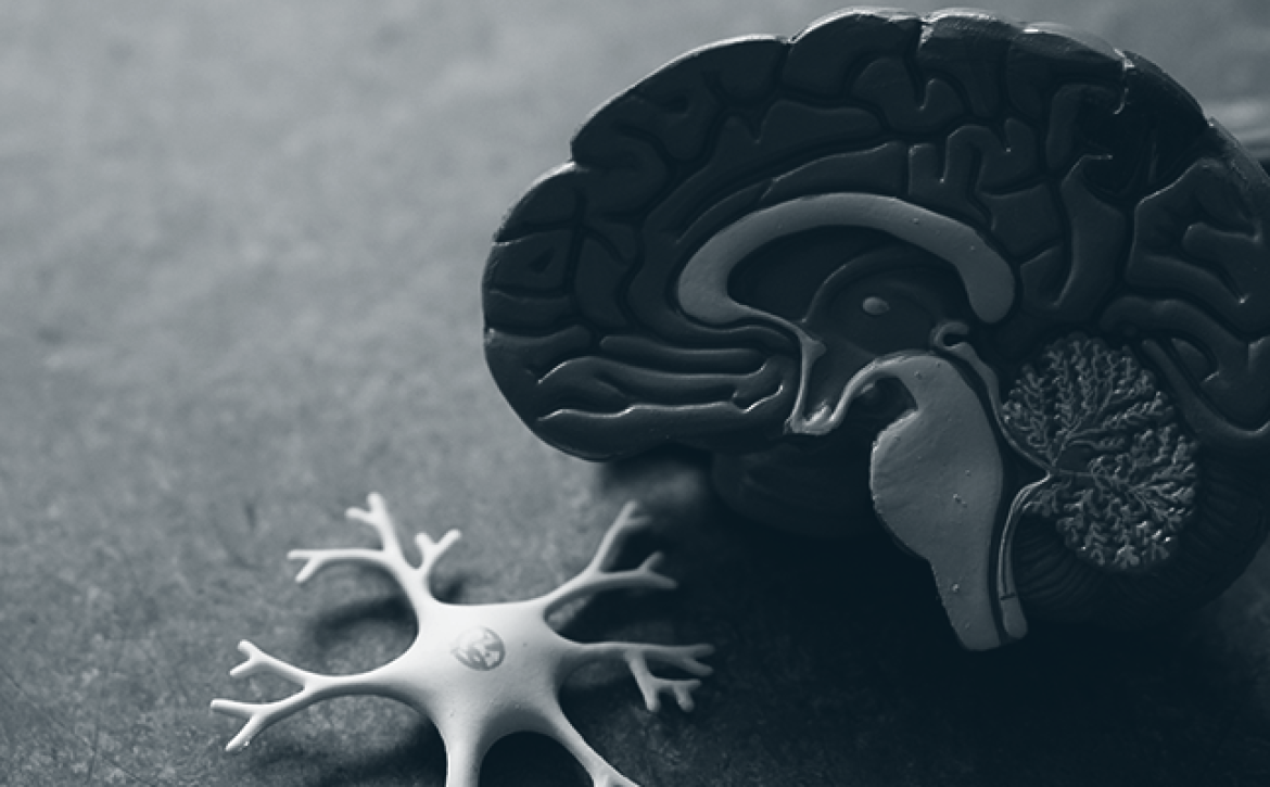 post concussion syndrome