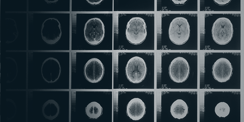 concussion awareness
