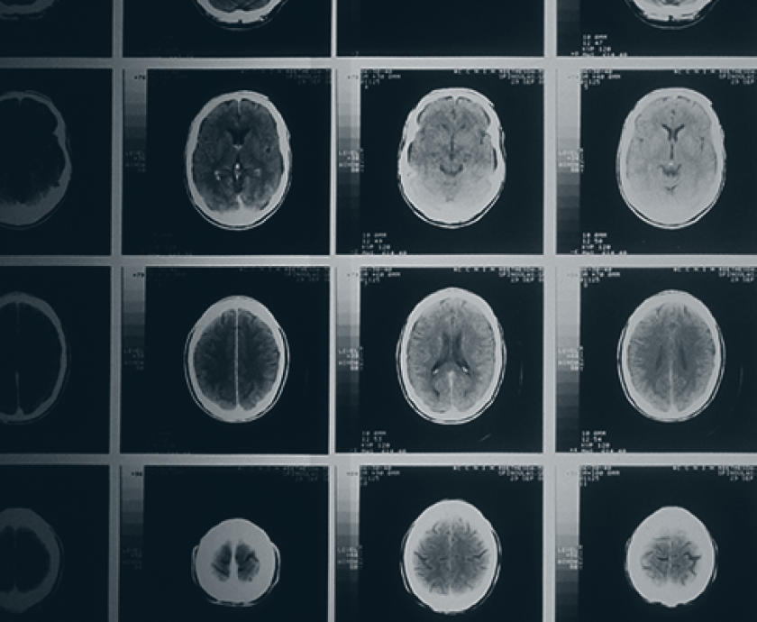 concussion awareness